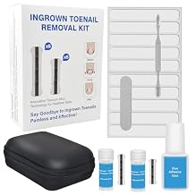 Upgraded ingrown toenail treatment, nail kit, Ingrown Toenail Treatment, Ingrown Toenail Removal Kit, Designed for Curved Nail Repair, Ingrown Toenail Corrector, Suitable for many types of correction.