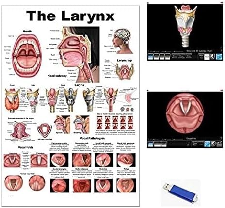 Blue Tree Publishing Larynx Poster With Software Larynx and Vocal Fold ID Speech Language Pathology, SLP, Singing