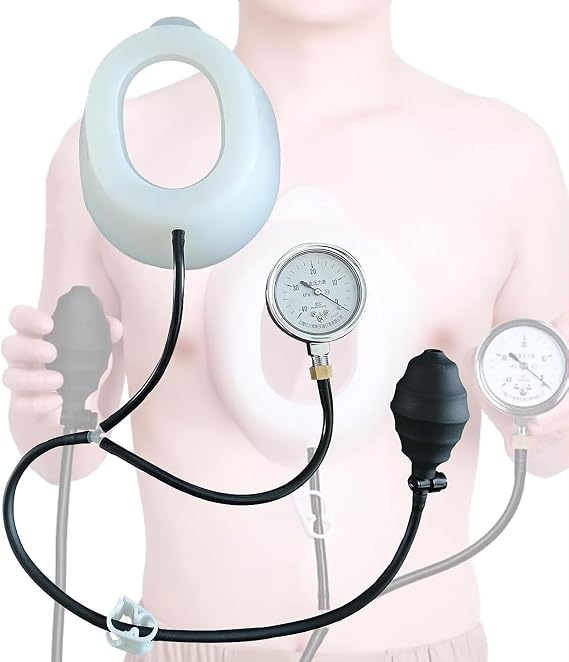 Pectus Excavatum Vacuum Bell, Pectus Excavatum Orthosis Brace, Sternal Depression Support for Sunken Chest, Sternum Brace with Pressure Gauge S