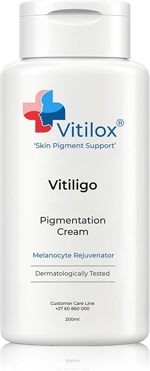 Vitilox Vitiligo Pigmentation Cream
