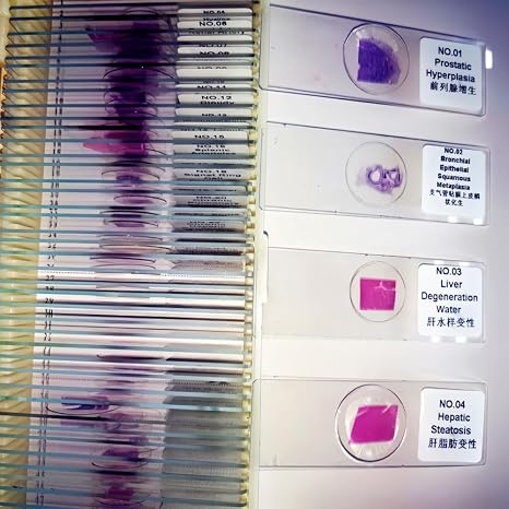 50Pcs/Set Human Pathology Slides Set Pathology Histology Prepared Microscope Slides
