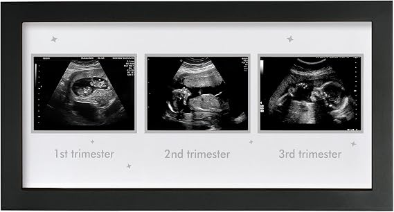 Ultrasound Picture Frame - Triple Sonogram Frame for Mom to Be | Pregnancy Photo Album Decor | Baby Nursery Essentials & Gender Reveal Gifts | First Trimester Keepsake & Pregnancy Must Haves, Black1