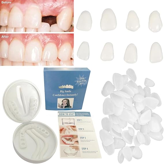 womcare Fake Tooth Repair Kits for Filling the Missing Broken Tooth and Gaps - Moldable Fake Teeth and Thermal Beads Replacement Kits