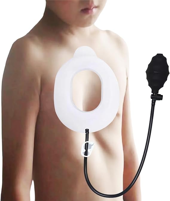 Pectus Excavatum Orthosis Brace, Pectus Excavatum Vacuum Bell, Sunken Sternum Brace for Adults and Child, Physical Correction of Pectus Excavatum, Adjustable Pressure L