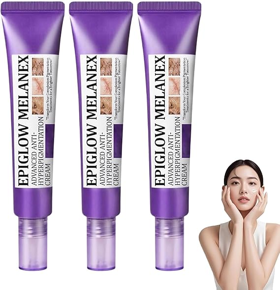 Dark spot remover for face, age spot remover reduces the appearance of old & new scars, melasma treatment cream for face, pigmentation freckles removal cream (30g, 3)