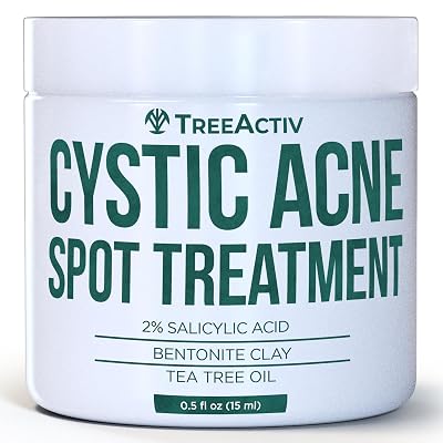 TreeActiv Salicylic Acid Cystic Acne Spot Treatment, 0.5 fl oz, for Face and Body, Cream for Hormonal Acne, Teens & Adults