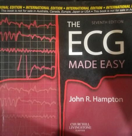 The ECG Made Easy